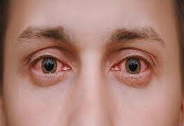 Eye disease spreads by coming in contact with infected not by seeing