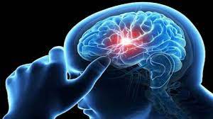 Infection can also occur in the brain,