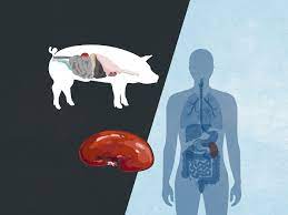 Pig's kidney is working in human