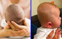 prevent the head of a newborn