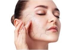 avoid dryness of skin