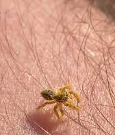 Spider climbing on the body